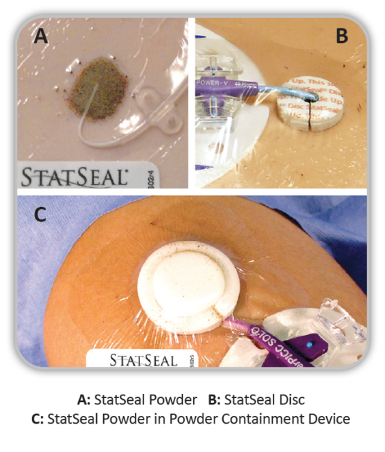 statseal-powder-disc-vascular-access